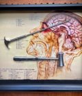 Lobotomy Shadowbox Display Large