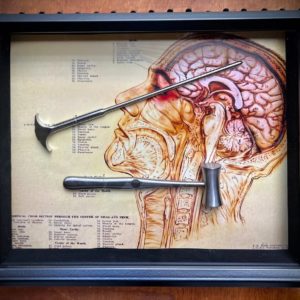 Lobotomy Shadowbox Display Large